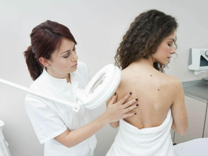 діагностика родимок