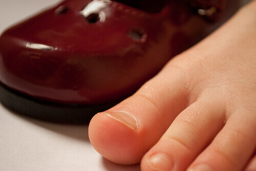 вростання нігтів та як із цим боротися