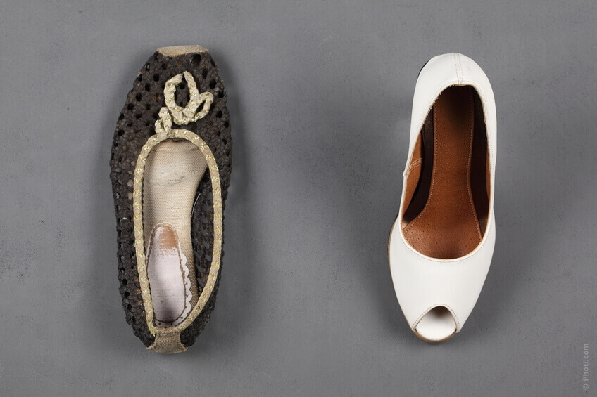 вростання нігтів через погане взуття