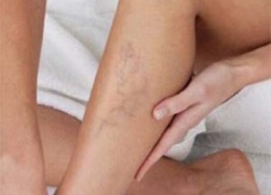 Як покращити циркуляцію крові