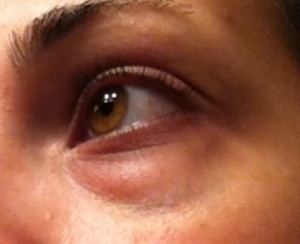 Мішки під очима? Сховайте їх природно!