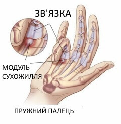 біль у руках