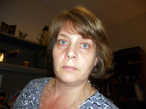 мішки під очима через втому