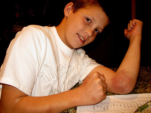 синець на лікті