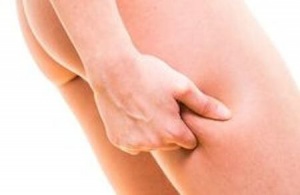Як боротися з целюлітом
