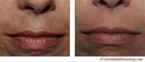 обличчя жінки, губи