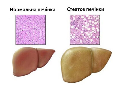 pechinka2ua