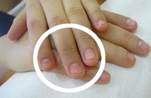 Поради: як перестати гризти нігті