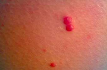 червоні додимки