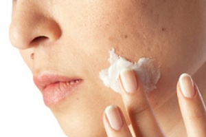 Як очистити шкіру від забруднень за один місяць
