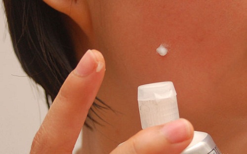 6 домашніх засобів, які ніколи не слід пробувати