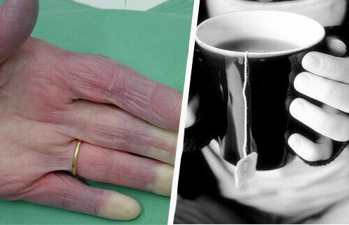 Холодні руки: причини, які повинен знати кожен