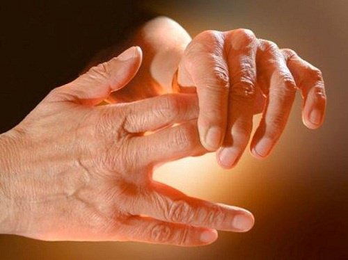 Чому виникають поколювання в руках і ногах