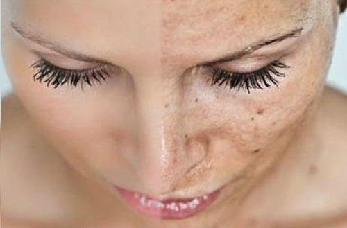 передчасне старіння шкіри