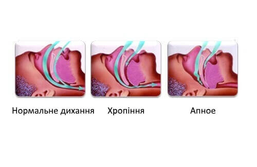Факти про хропіння
