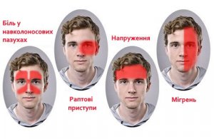 Новий та ефективний засіб лікування мігрені