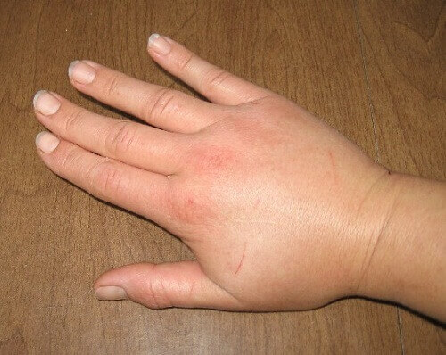 при затримці рідини в організмі варто перевірити своє здоров'я