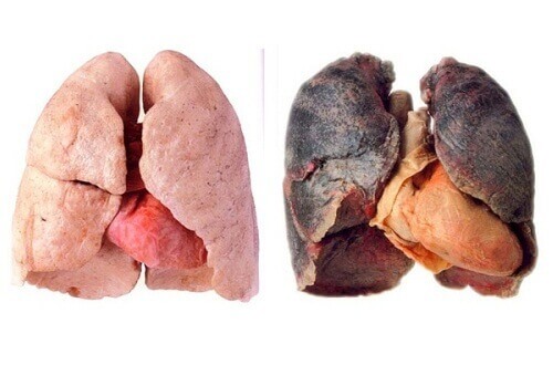 Поради для очищення легень