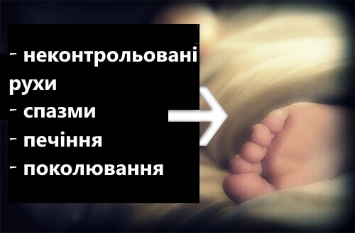 Синдроми поколювання