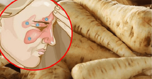 Вас турбує синусит? П’ять днів і ви здорові!