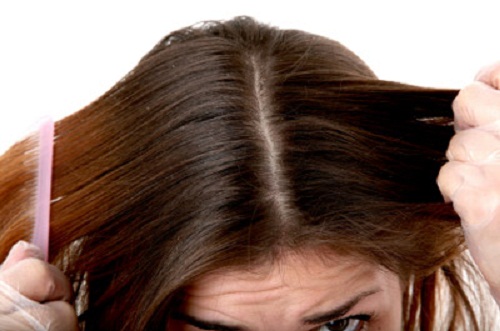 яблучний оцет зменшує появу лупи та укріплює волосся