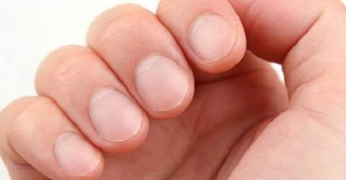 8 знаків на нігтях, що говорять про ваше здоров’я