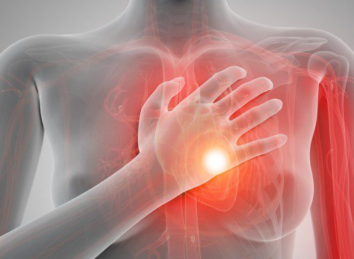 серцевий напад та його симптоми