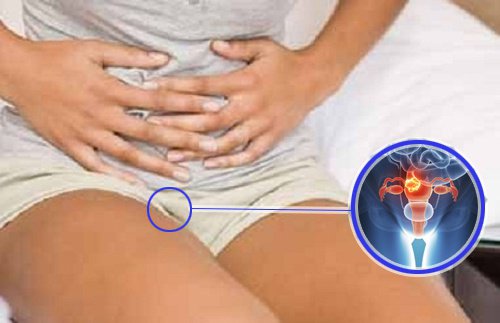 7 попереджувальних ознак раку шийки матки