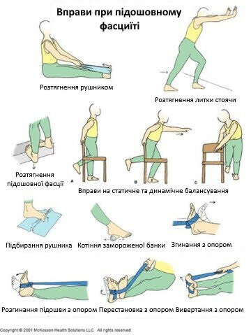 вправи для лікування п'яткової шпори