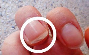 Як укріпити нігті