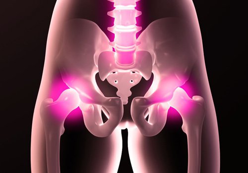 Звички, які можуть призвести до пошкодження стегна