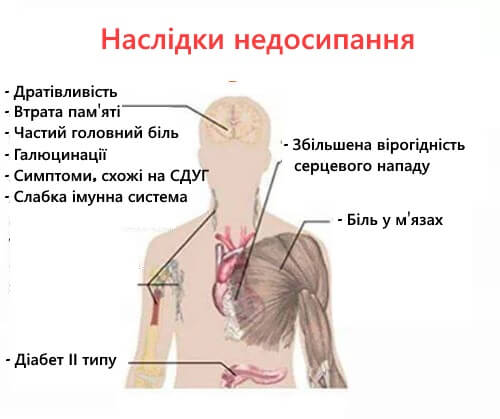 7 серйозних наслідків недосипання