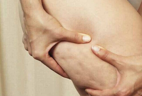 7 продуктів, які збільшують або викликають целюліт