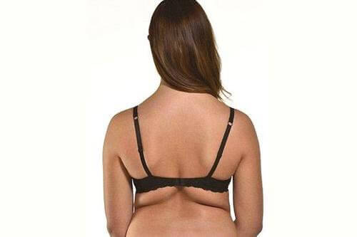 Як позбутися жирових складок на спині