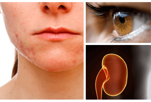 Органи, які найбільше страждають від стресу