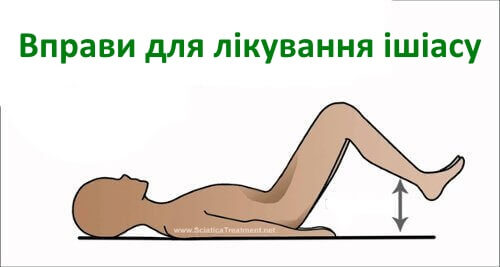 Вправи для полегшення болю сідничного нерва