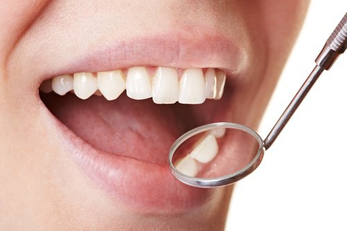 Як легко усунути зубний наліт у домашніх умовах