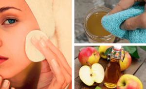 Переваги використання яблучного оцту для вмивання обличчя