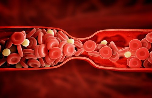 atrovastatin-vid-kholesterynu
