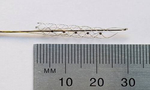 "Біонічний хребет" допомагає паралізованим людям знову ходити