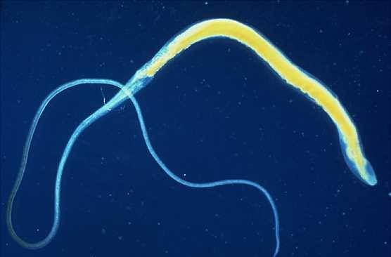 кишкові паразити