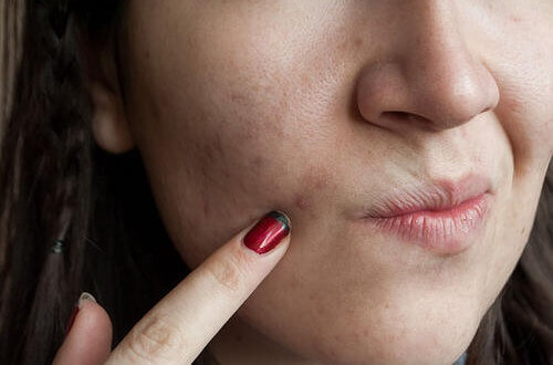 7 звичок, які шкодять шкірі