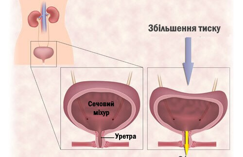 сечовий міхур