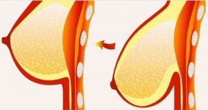 8 практичних порад від обвисання грудей