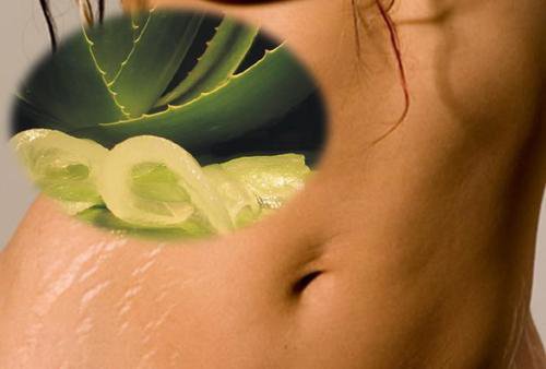 6 натуральних засобів проти розтяжок