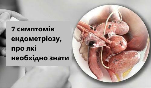 7 симптомів ендометріозу, про які необхідно знати