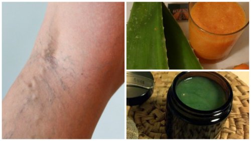 Бабусин засіб від варикозного розширення вен