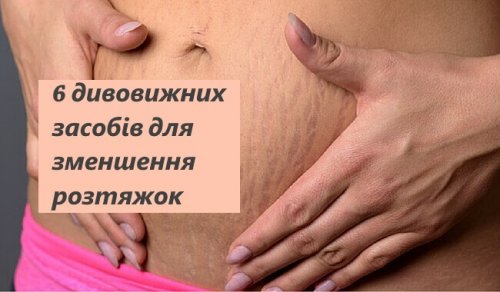 6 дивовижних засобів для зменшення розтяжок
