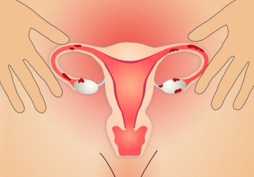 згустки крові у період менструації