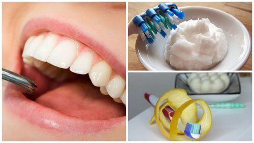 6 натуральних способів зняти зубний наліт